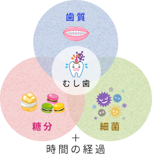 むし歯の原因となる3つの要素